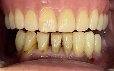 Phuket Dental Phuket Dental