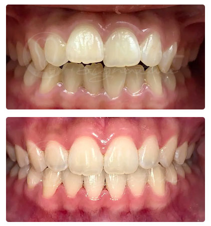Phuket Dental Phuket Dental
