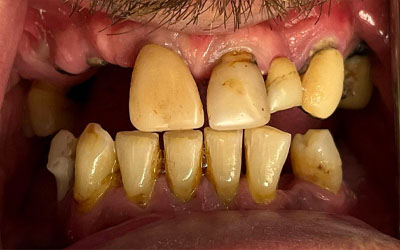 Phuket Dental Phuket Dental