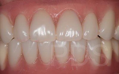 Phuket Dental Phuket Dental