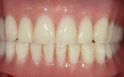Phuket Dental Phuket Dental
