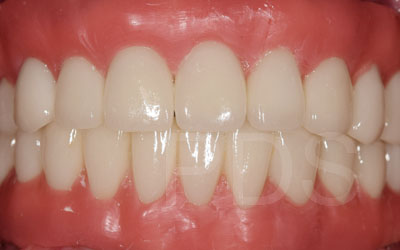 Phuket Dental Phuket Dental