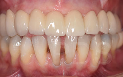 Phuket Dental Phuket Dental