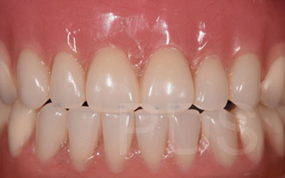 Phuket Dental Phuket Dental