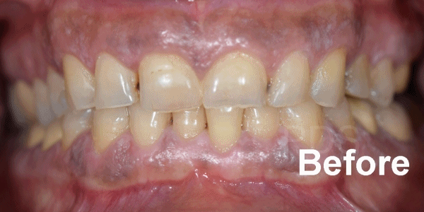 Phuket Dental Phuket Dental