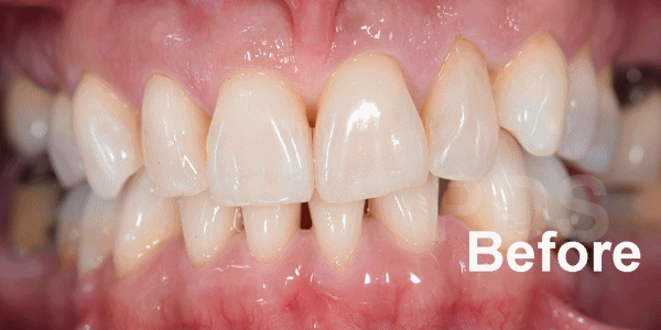 Phuket Dental Phuket Dental